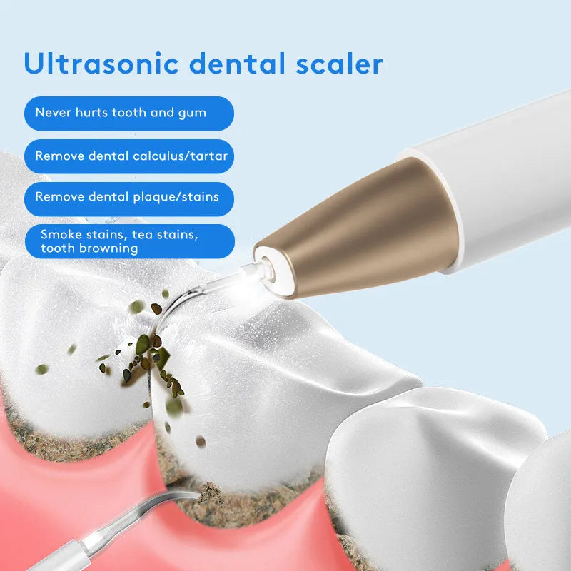 Gold-coloured handheld ultrasonic tooth cleaning device for tartar and stain removal