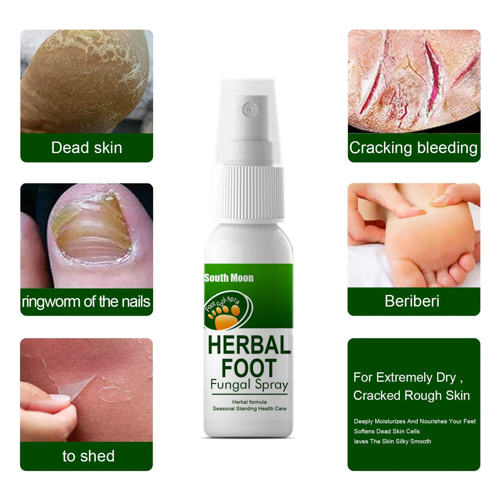 30ml foot care spray bottle for skin nourishment and hydration treatment