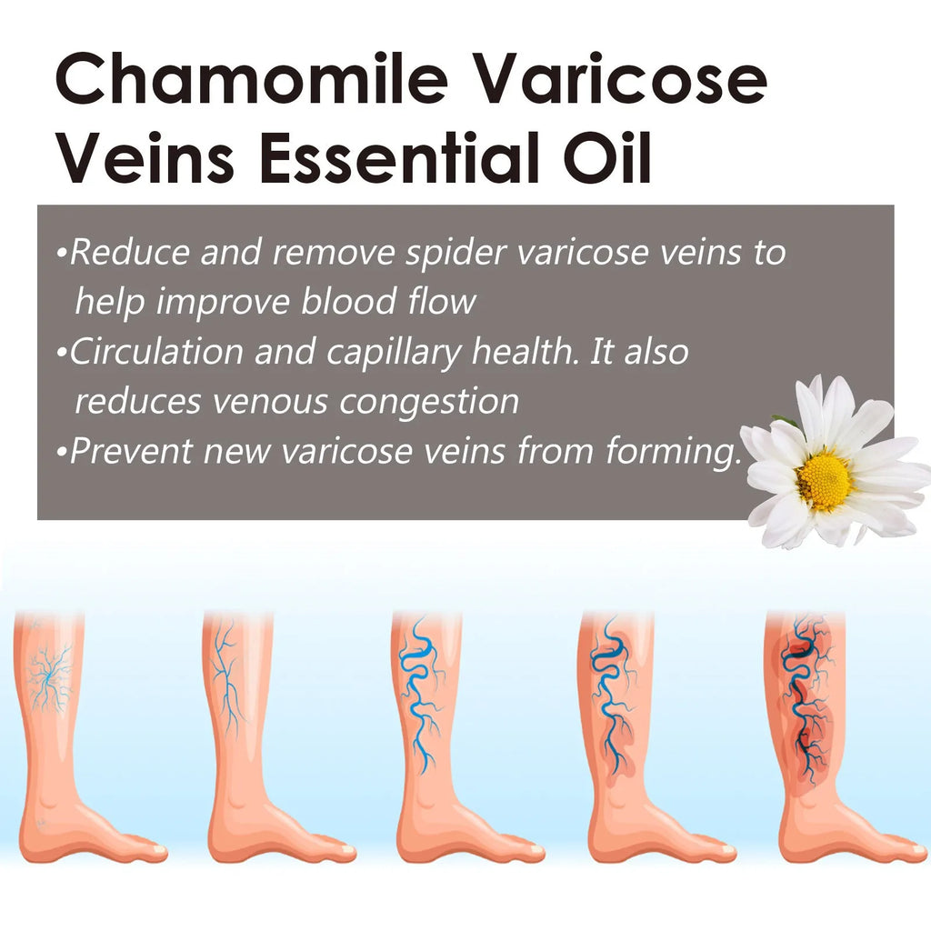 10ml bottle of chamomile leg essential oil for massage and topical application