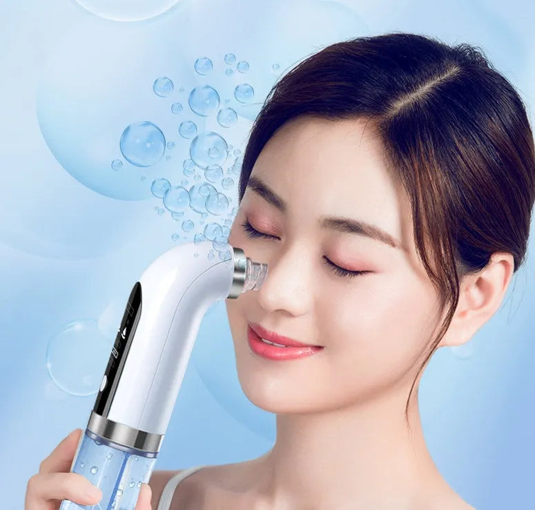 Rechargeable blackhead remover vacuum with six replaceable probes, five suction levels, white colour, and USB charger.