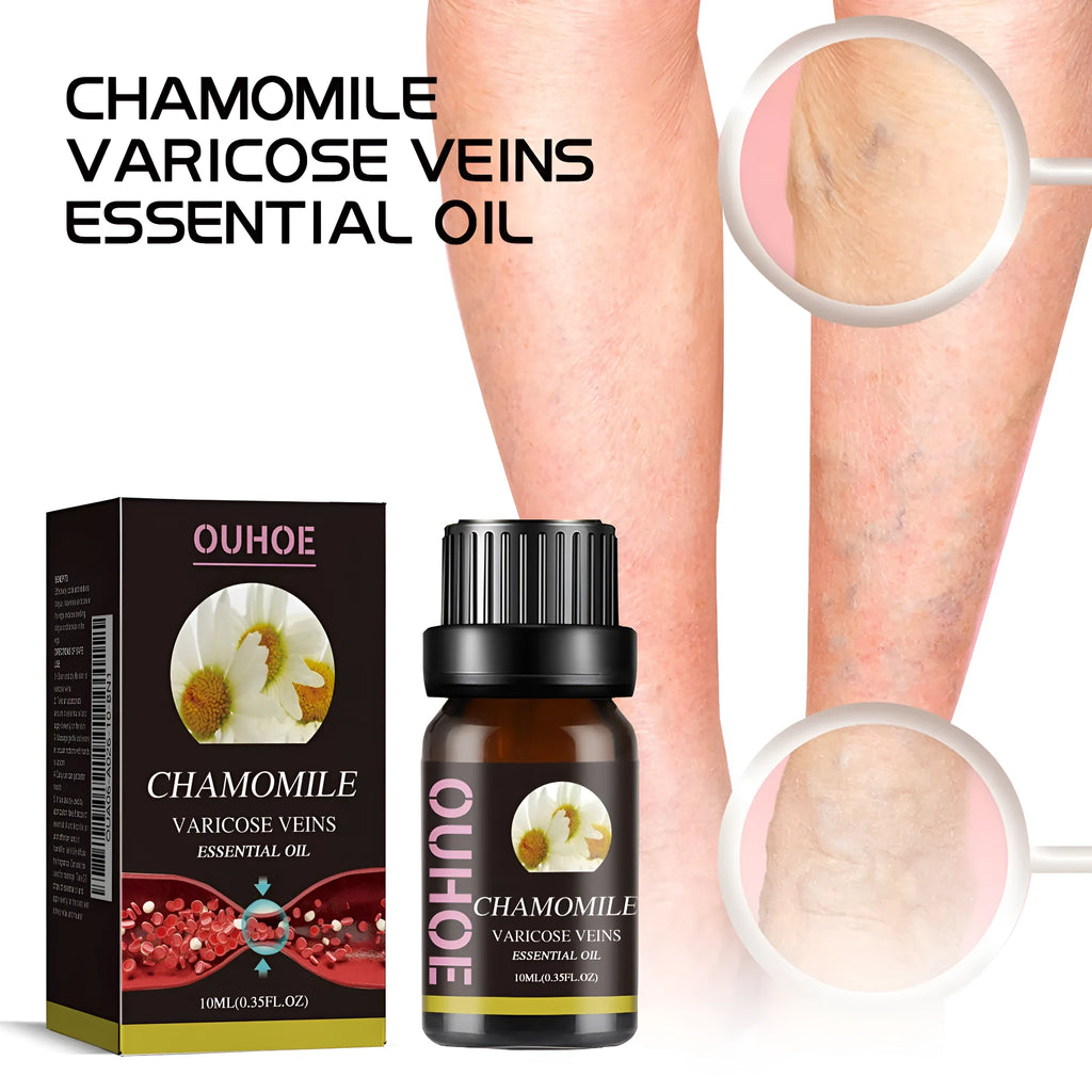 10ml bottle of chamomile leg essential oil for massage and topical application