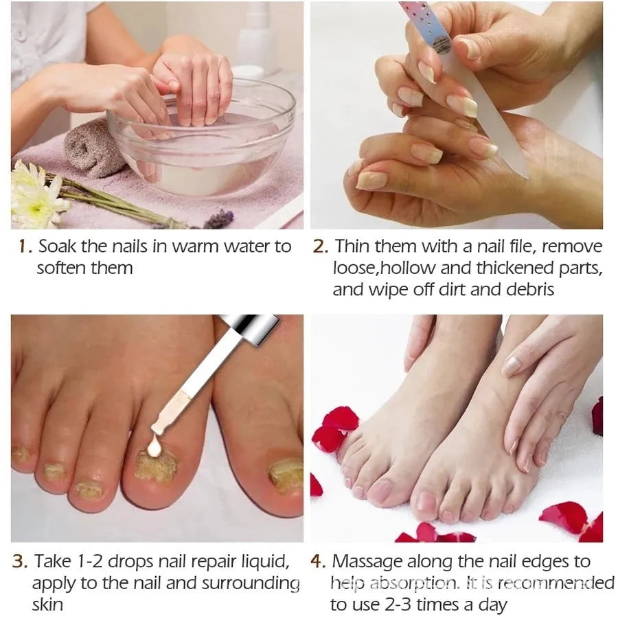 10ml bottle of deck liquid antimicrobial foot repair dust for nail whitening