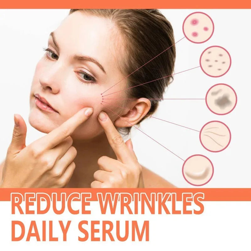 30ml bottle of rose essential oil for facial skin brightening and wrinkle reduction