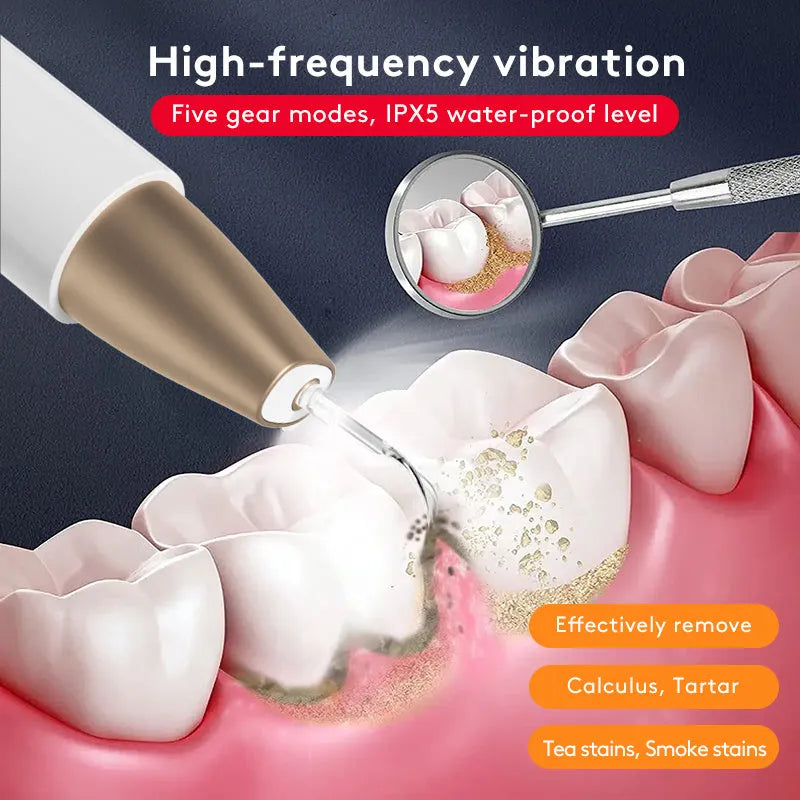 Gold-coloured handheld ultrasonic tooth cleaning device for tartar and stain removal