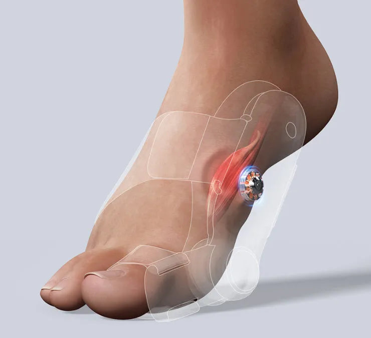 White plastic electric hallux valgus toe separator with adjustment controls and a USB Type-C charging port.
