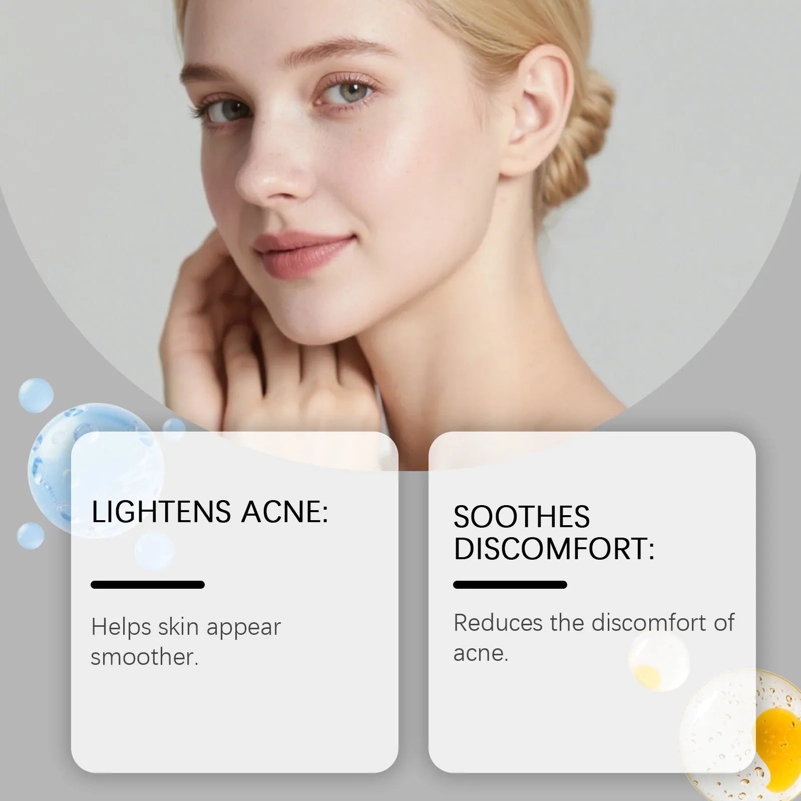 Sheet of 80 round, translucent hydrocolloid acne patches on a clear backing.