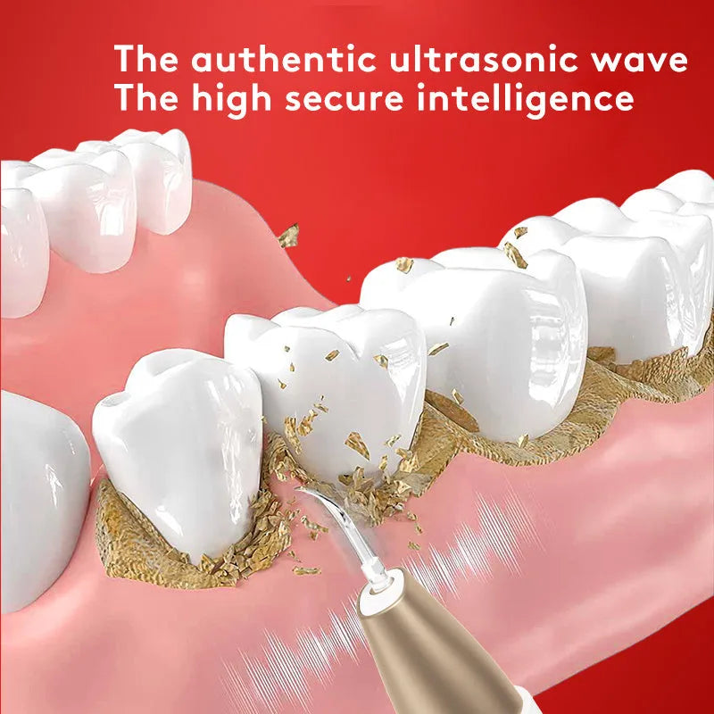 Gold-coloured handheld ultrasonic tooth cleaning device for tartar and stain removal